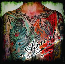 Assert : Laser Tattoo Removal Service